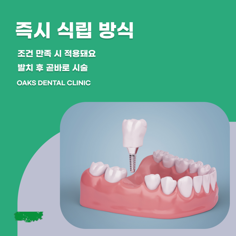 압구정동치과 임플란트종류 나에게 맞는 치료는 무엇일까 관련 이미지 3