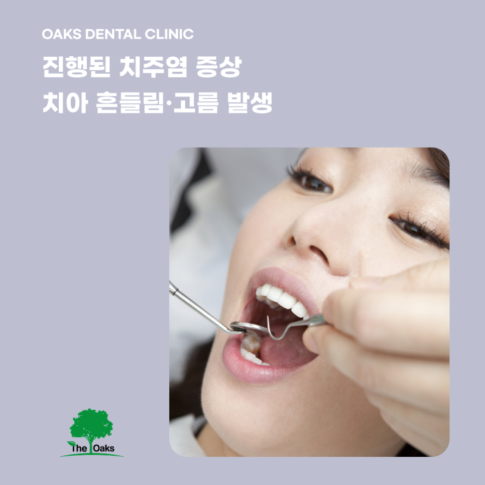 압구정동치과 치주염증상 조용히 다가오는 잇몸의 경고 관련 이미지 3
