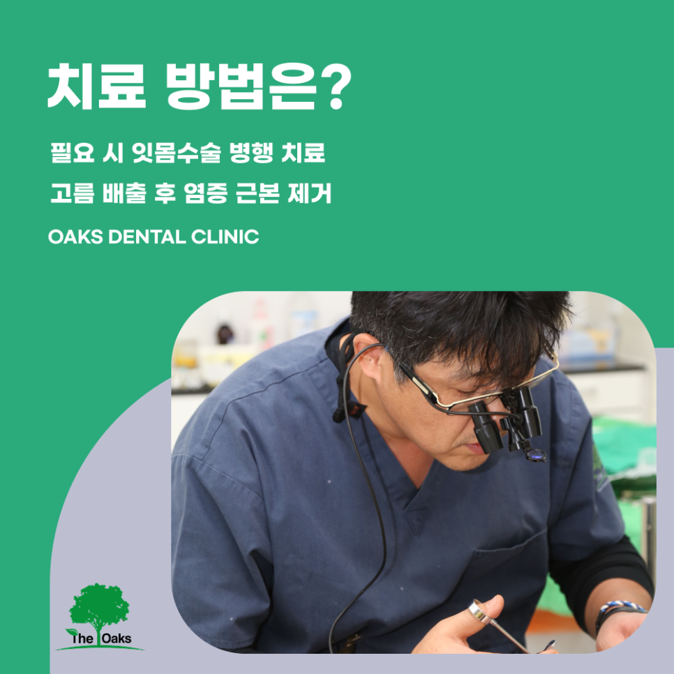청담동치과 잇몸고름주머니 방치하면 치아까지 위험할 수 있어요 관련 이미지 4