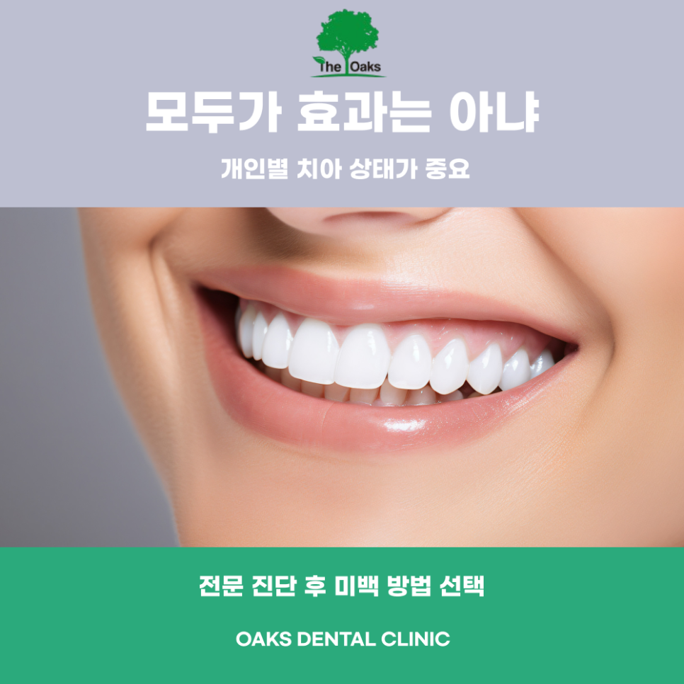 논현동치과 치아미백에 대한 오해와 진실 알아보아요 관련 이미지 5