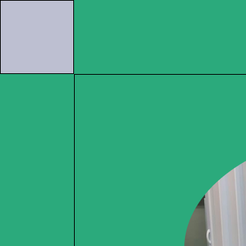 도곡동치과 임플란트기간 얼마나 걸릴까 단계별 과정부터 회복까지 안내 관련 이미지 8