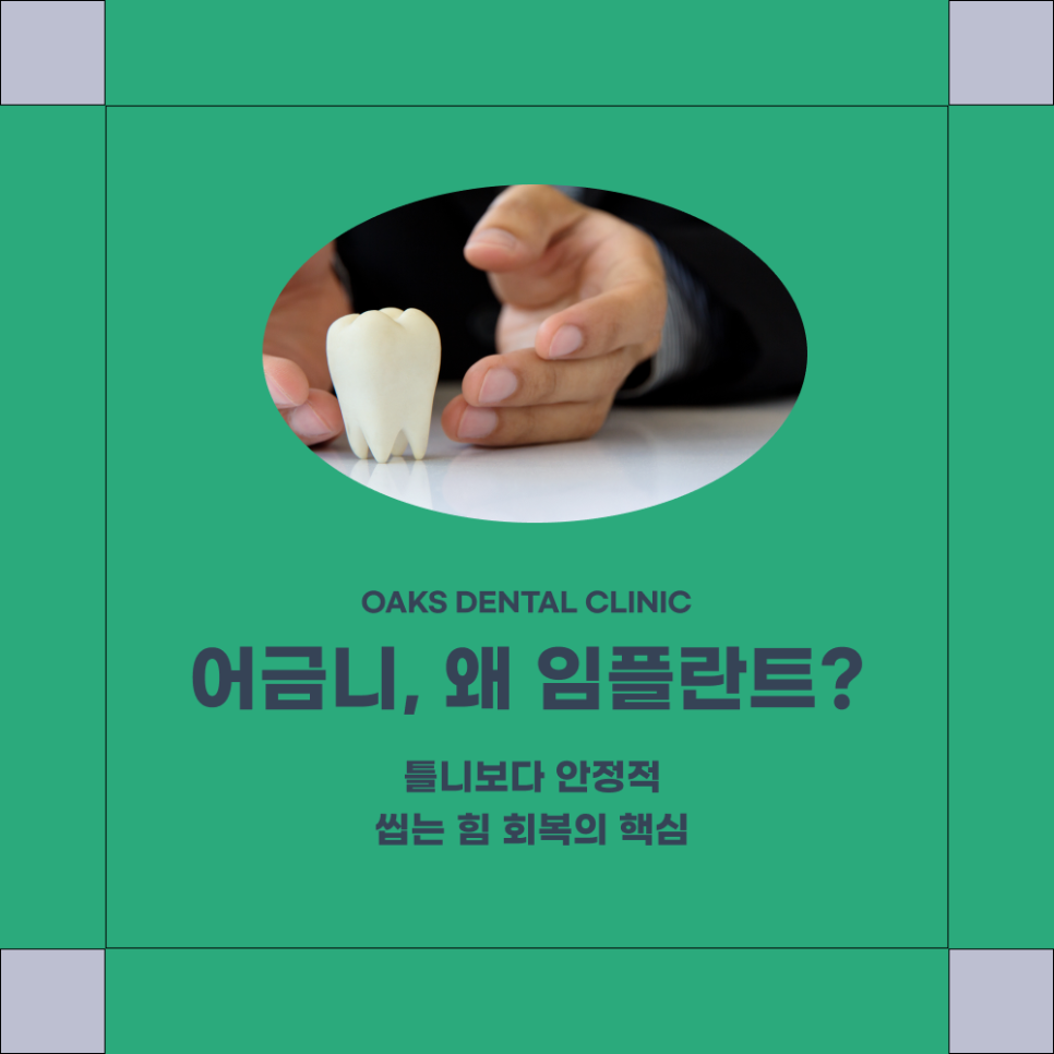 강남구치과 어금니임플란트 꼭 필요한 이유와 과정 관련 이미지 1