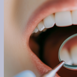 역삼동치과 잇몸고름주머니 방치하면 위험한 이유 원인부터 치료까지 관련 이미지 12