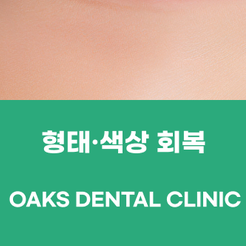 강남역치과 앞니크라운 자연스러운 미소를 위한 심미 보철 치료 관련 이미지 15
