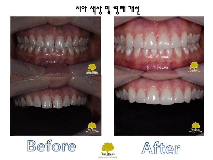 강남라미네이트가격 더 예뻐질 나를 위해 관련 이미지 3