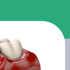 세곡동치과 뼈이식임플란트 부족한 잇몸뼈를 보완해 성공률을 높이는 방법 관련 이미지 13