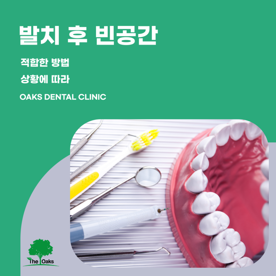 강남치과 발치 꼭 필요할 때만 진행하는 이유와 과정 이야기 관련 이미지 5