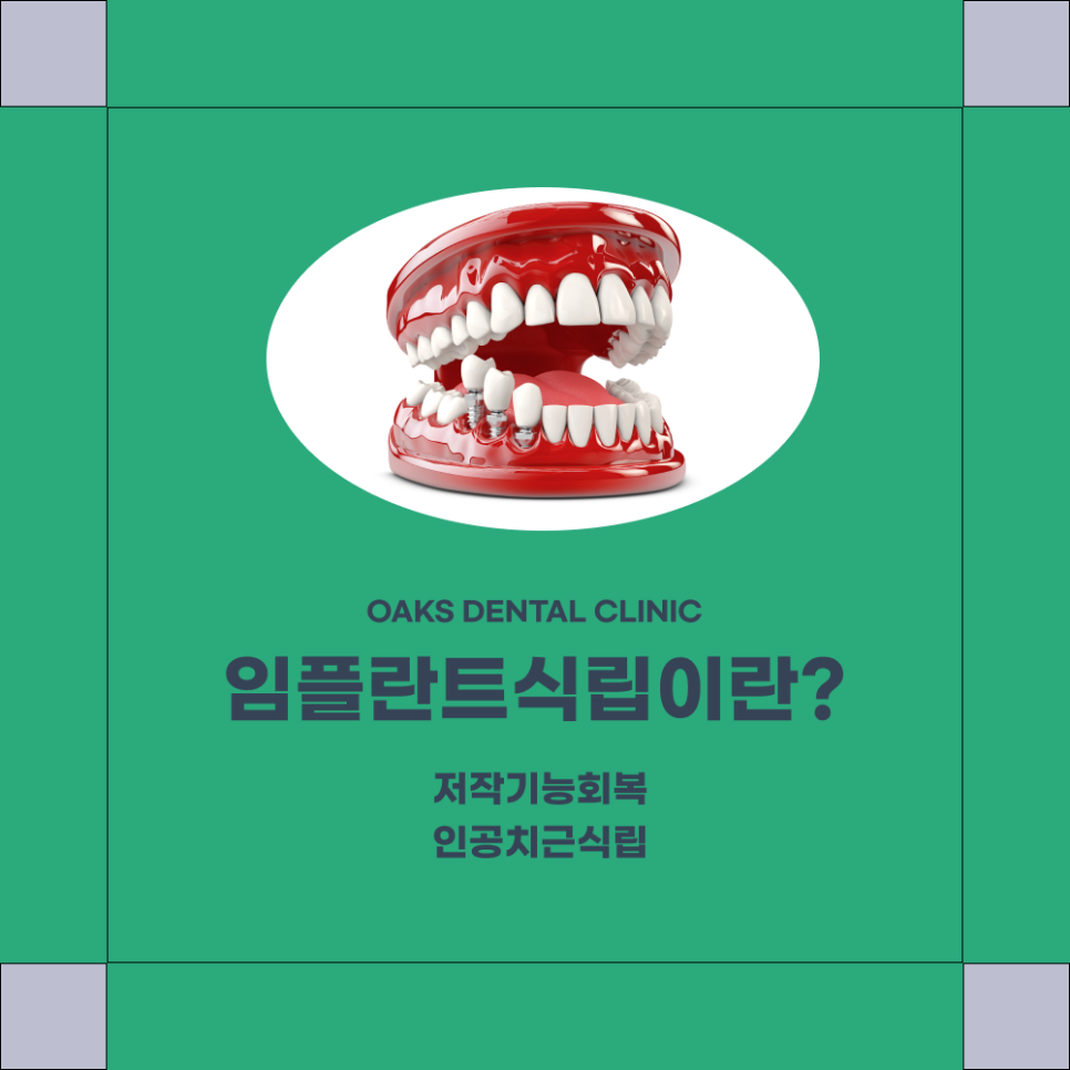 강남치과 임플란트식립 새로운 삶의 질을 선사하는 상실 치아의 완전한 재건 관련 이미지 1