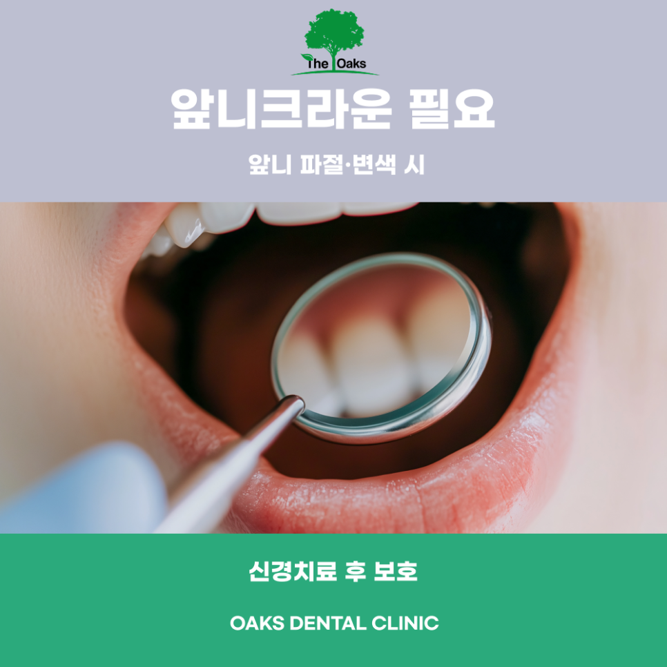 강남역치과 앞니크라운 자연스러운 미소를 위한 심미 보철 치료 관련 이미지 2