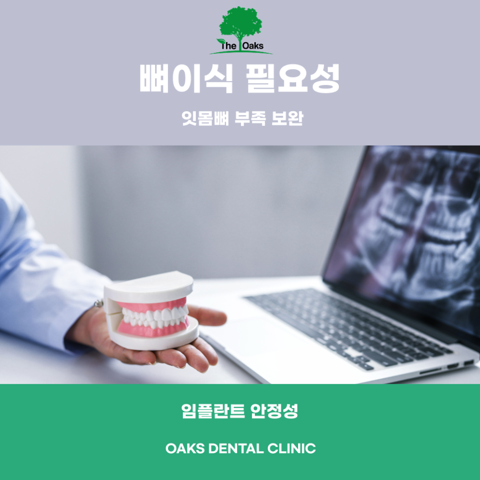 역삼동치과 임플란트뼈이식, 성공적인 임플란트를 위한 필수 과정 관련 이미지 1