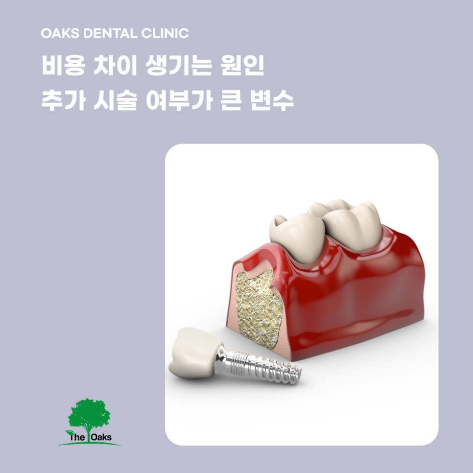 대치동치과 임플란트비용 차이나는 이유 알아보아요 관련 이미지 2