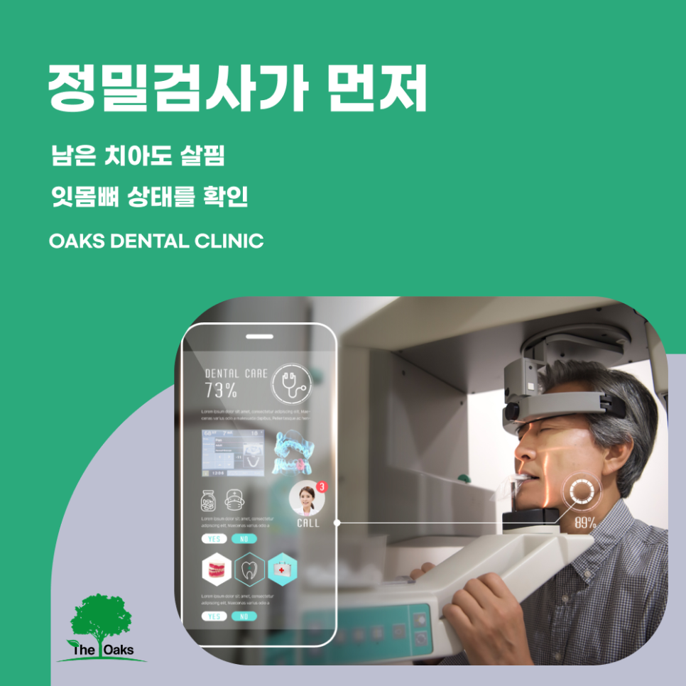 세곡동치과 전체임플란트 어떤 경우에 필요할까요? 관련 이미지 2