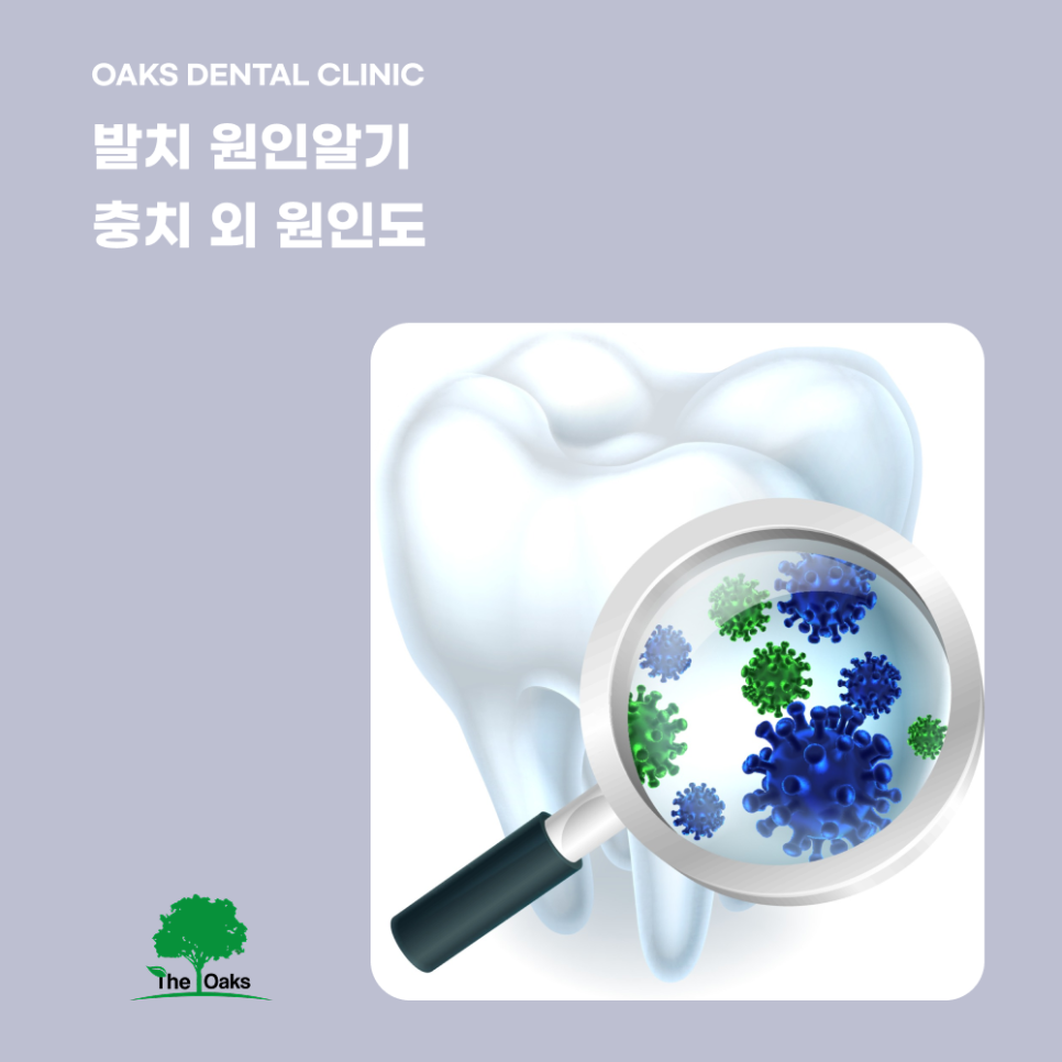 교대역치과 발치 꼭 필요한 경우와 치료 후 관리까지 관련 이미지 2