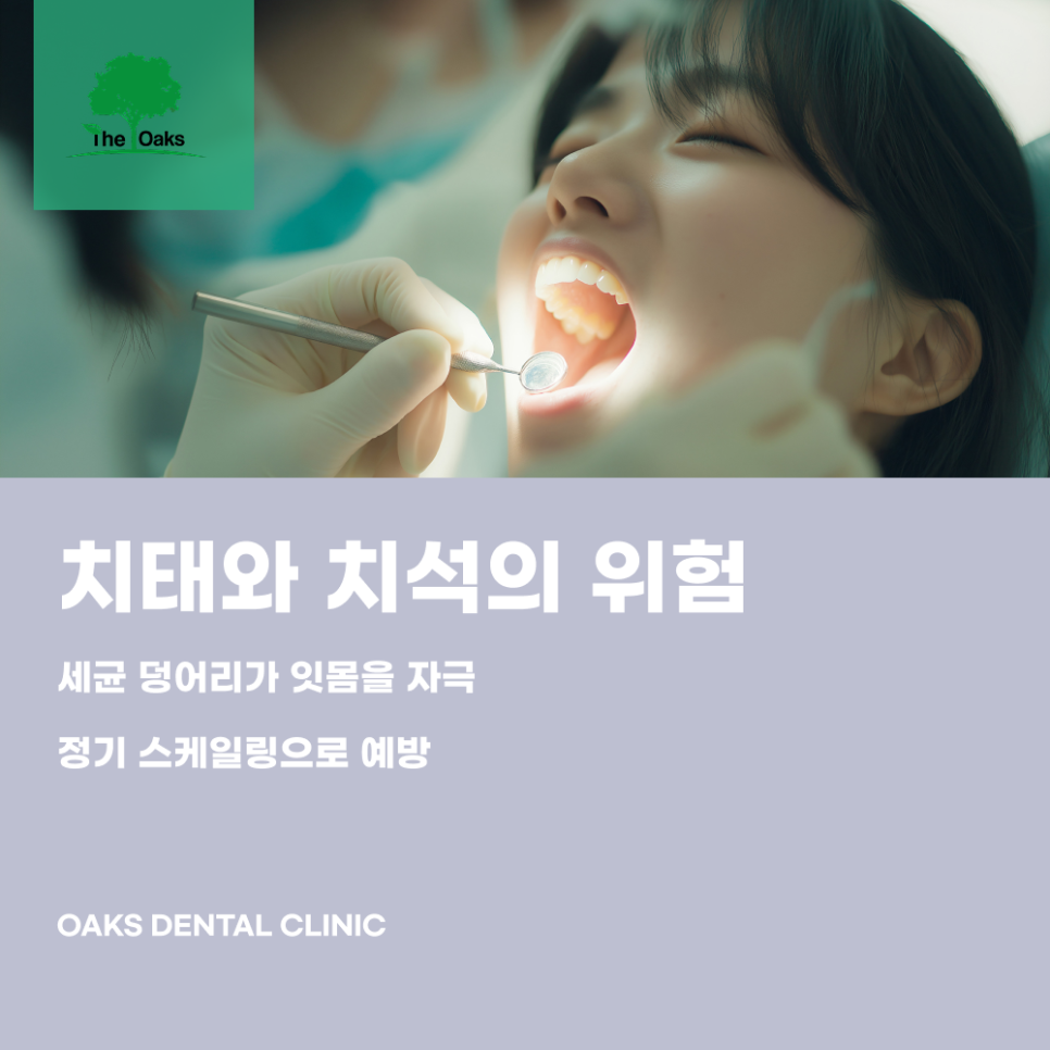 역삼동치과 잇몸염증 방치하면 치아 손실로 이어집니다 관련 이미지 2
