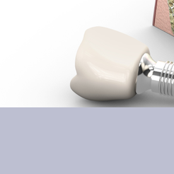 신사동치과 임플란트부작용 미리 알수록 예방할 수 있습니다 관련 이미지 14