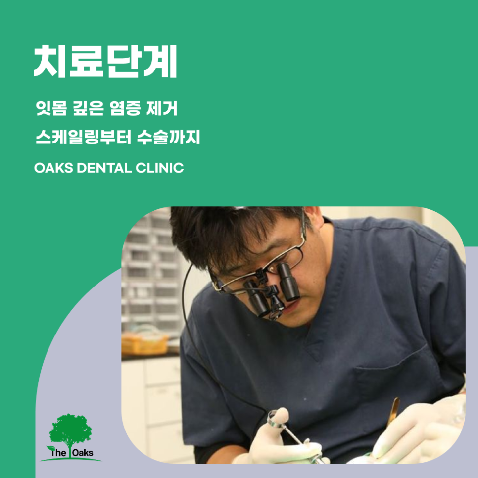 자곡동치과 치주염치료 잇몸 속 염증부터 잡아야 건강이 회복됩니다 관련 이미지 4