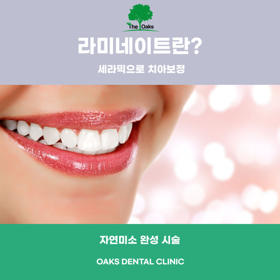 개포동치과 라미네이트로 자연스럽고 반짝이는 미소 완성하세요 관련 이미지 1