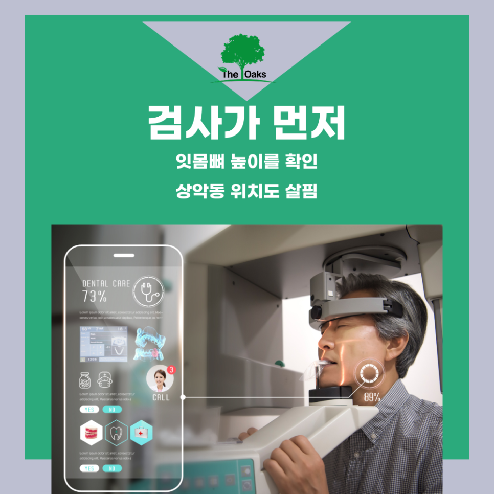 개포동치과 상악동거상술은 어떻게 진행될까요? 관련 이미지 3