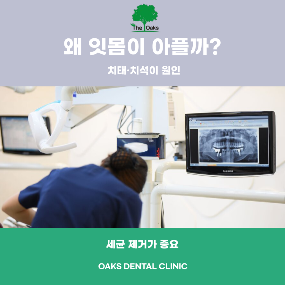 강남치과 잇몸치료 완전 정리 관련 이미지 2