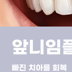 삼성동치과 앞니임플란트 자연스러운 결과를 위해 중요한 것 관련 이미지 11