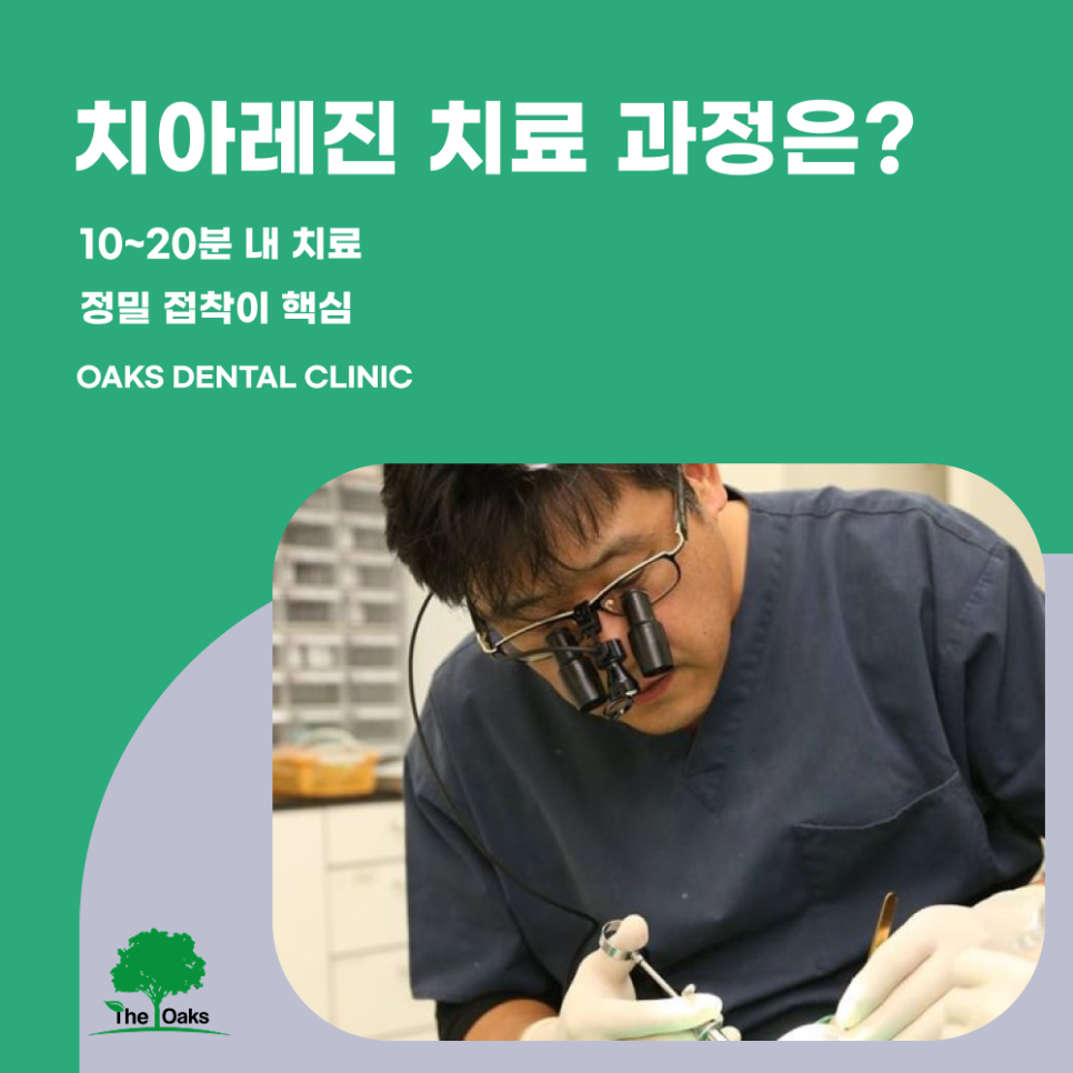 신사동치과 치아레진 자연스러움과 보존을 동시에 잡는 치료 관련 이미지 3