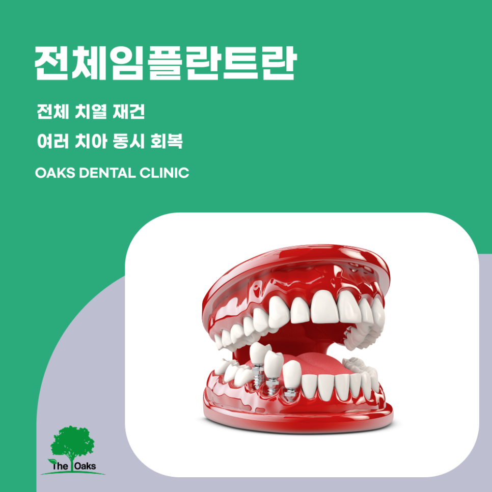 논현동치과 전체임플란트 여러 치아를 동시에 회복하는 체계적인 치료 관련 이미지 1