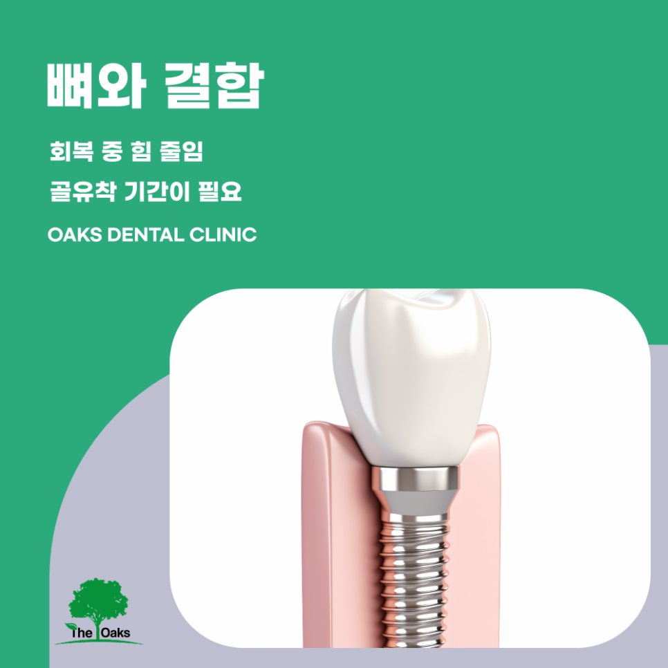 개포동치과 임플란트과정 단계별로 알아보는 치료의 흐름 관련 이미지 3