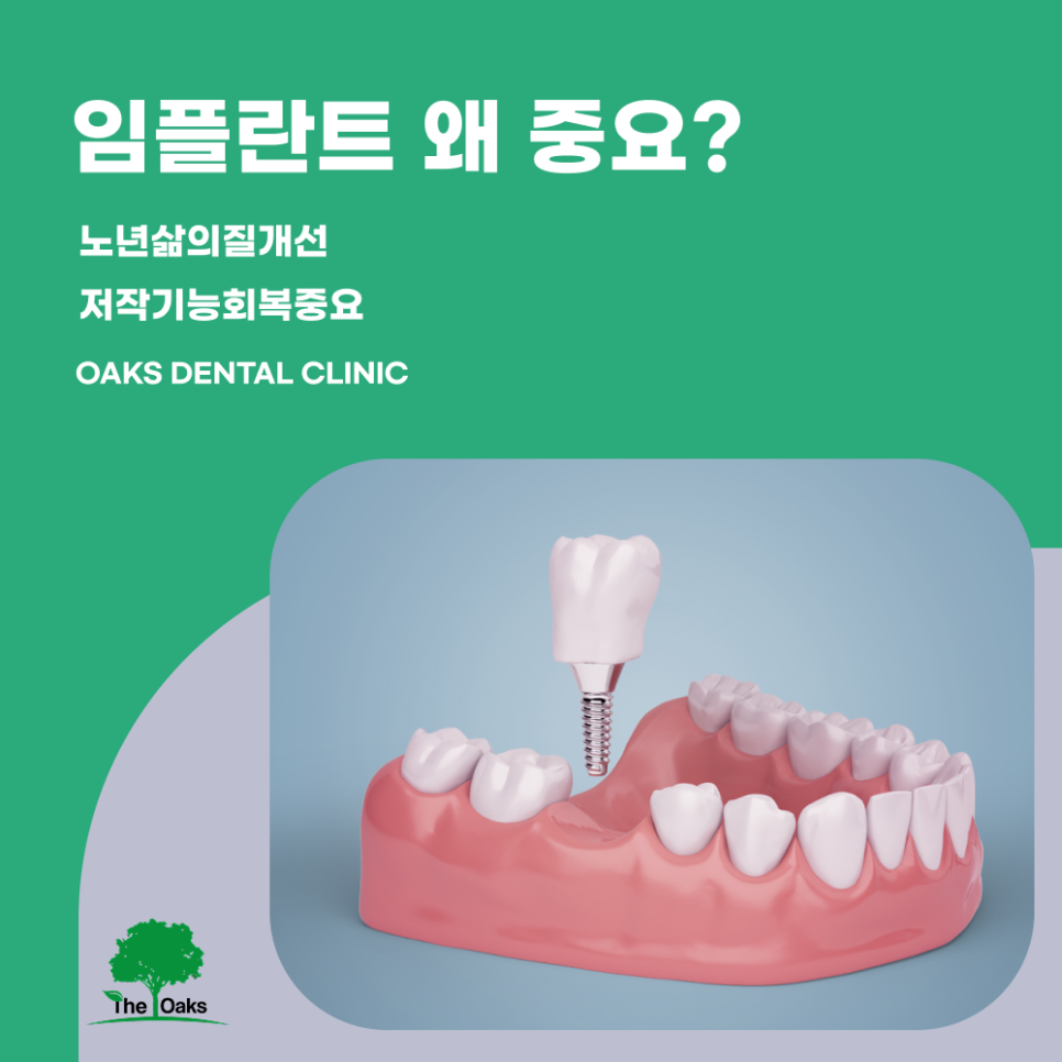 세곡동치과 65세임플란트 건강보험 적용으로 부담 줄이는 현명한 선택 관련 이미지 1
