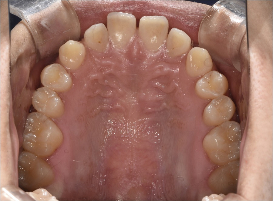 신논현치과 치아 건강을 위하여 관련 이미지 5