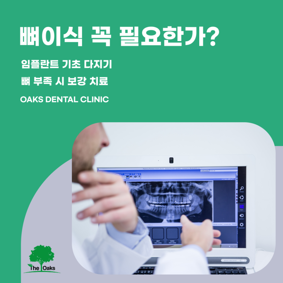 세곡동치과 잇몸뼈이식 임플란트의 견고한 토대 만들기 관련 이미지 2