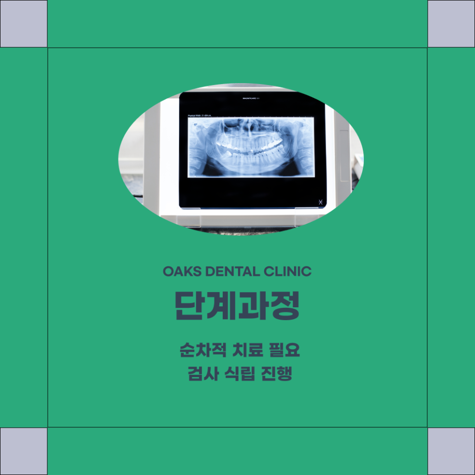 도곡동치과 임플란트기간 얼마나 걸릴까 단계별 과정부터 회복까지 안내 관련 이미지 3