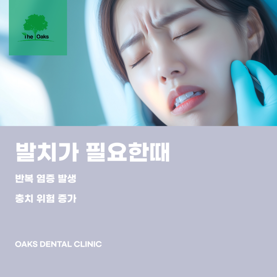 개포동치과 매복사랑니발치 통증이 없더라도 확인이 필요한 이유 관련 이미지 3