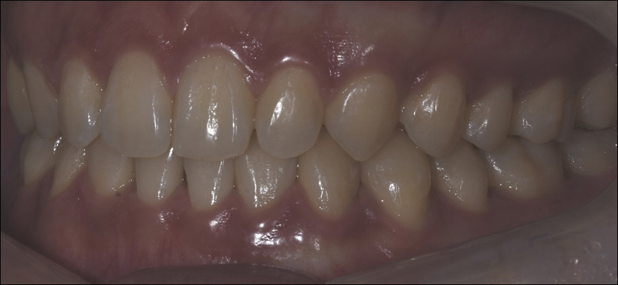 신논현치과 치아 건강을 위하여 관련 이미지 4