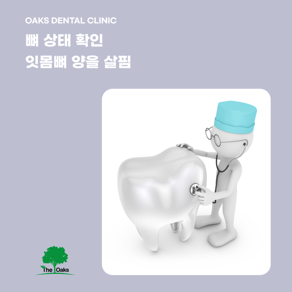 삼성동치과 앞니임플란트 자연스러운 결과를 위해 중요한 것 관련 이미지 3