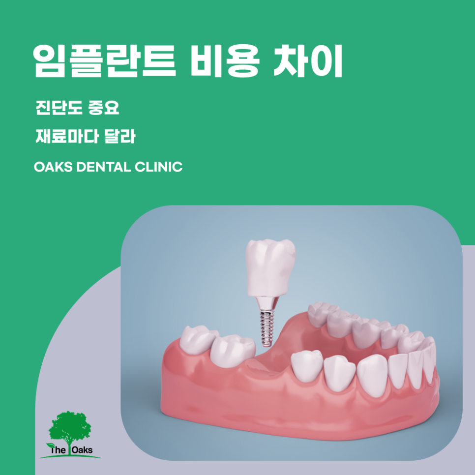 논현동치과 임플란트비용 합리적인 선택을 위한 체크포인트 관련 이미지 1