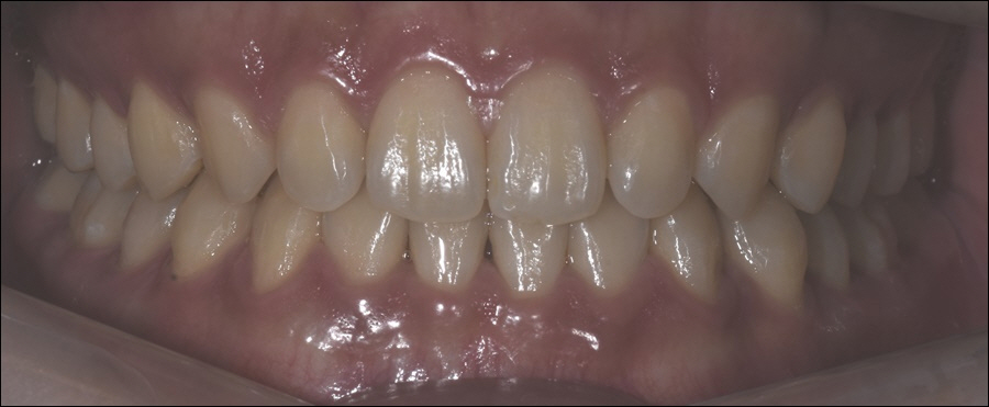 신논현치과 치아 건강을 위하여 관련 이미지 2