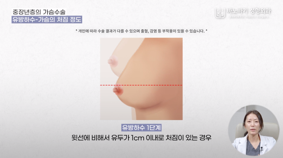 당신의 가슴은 원래 예뻤다, 중년 가슴성형 파헤치기! 관련 이미지 4