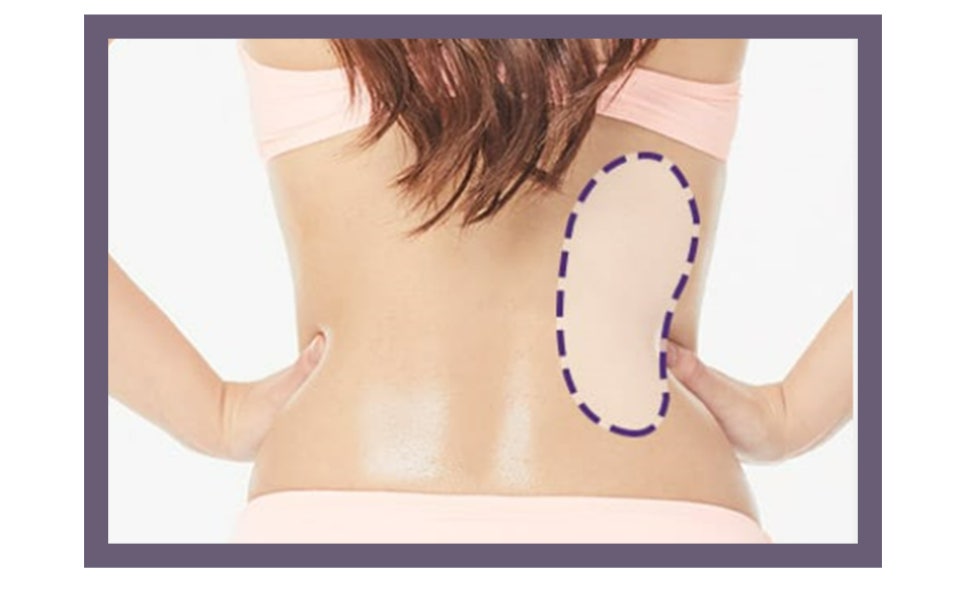 유방암 치료 후 가슴 재건 시기와 수술 방법 관련 이미지 8