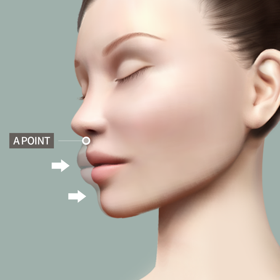 돌출 입, 쏙 집어넣는 방법! 관련 이미지 3