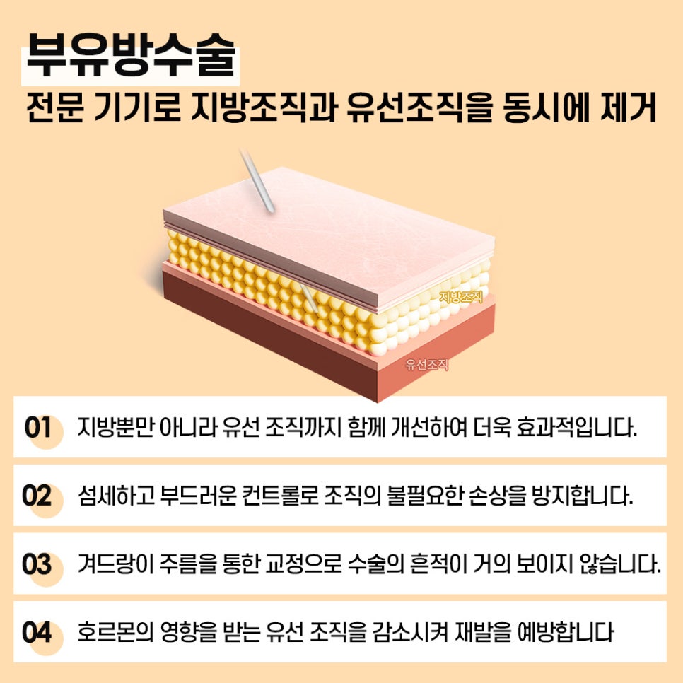 가슴부터 팔뚝까지 조화를 고려하는 부유방 수술 관련 이미지 4