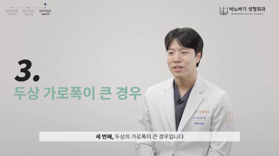 윤곽수술 최악의 부작용은? 이런 분들은 수술 금지! 관련 이미지 5