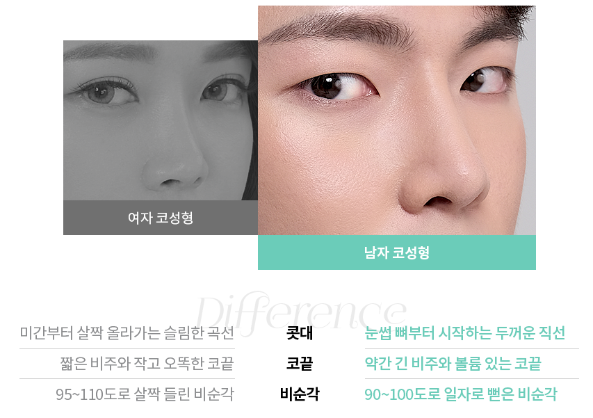 잘생김의 시작, 남자 코성형 관련 이미지 3