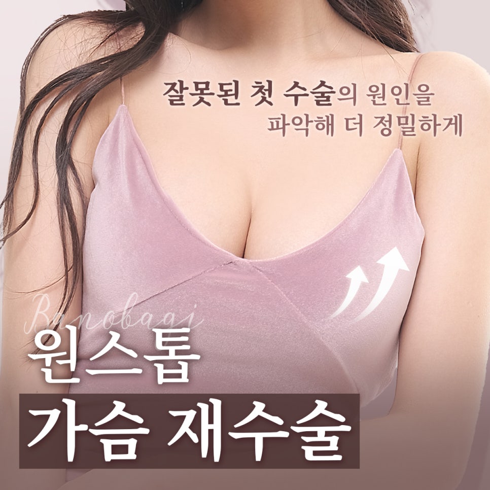 더 이상 추가 수술 없이 아름답게, 가슴 재수술 관련 이미지 1