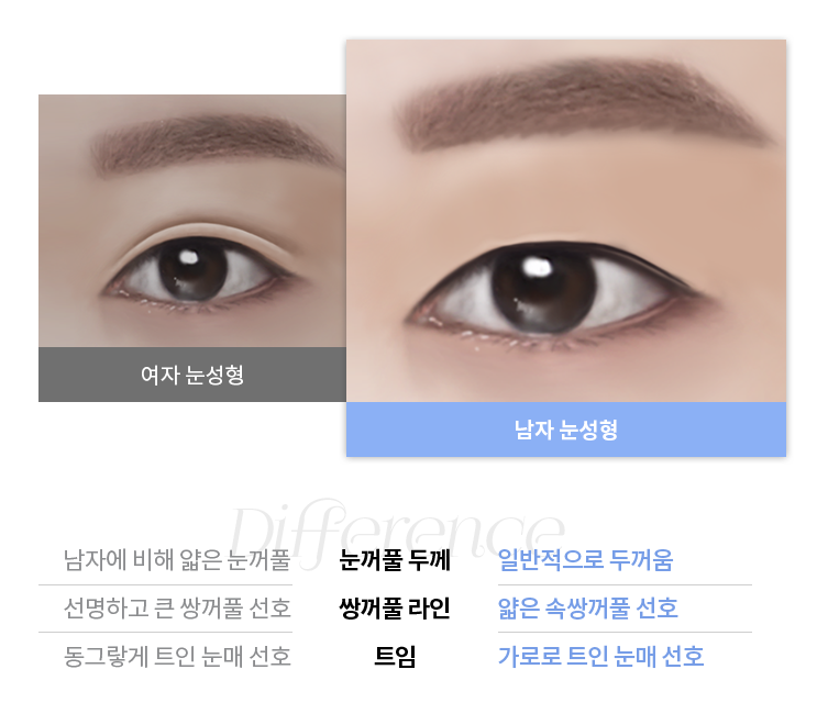 자연스럽지만 또렷한 &lsquo;남자 눈성형&rsquo; 관련 이미지 3