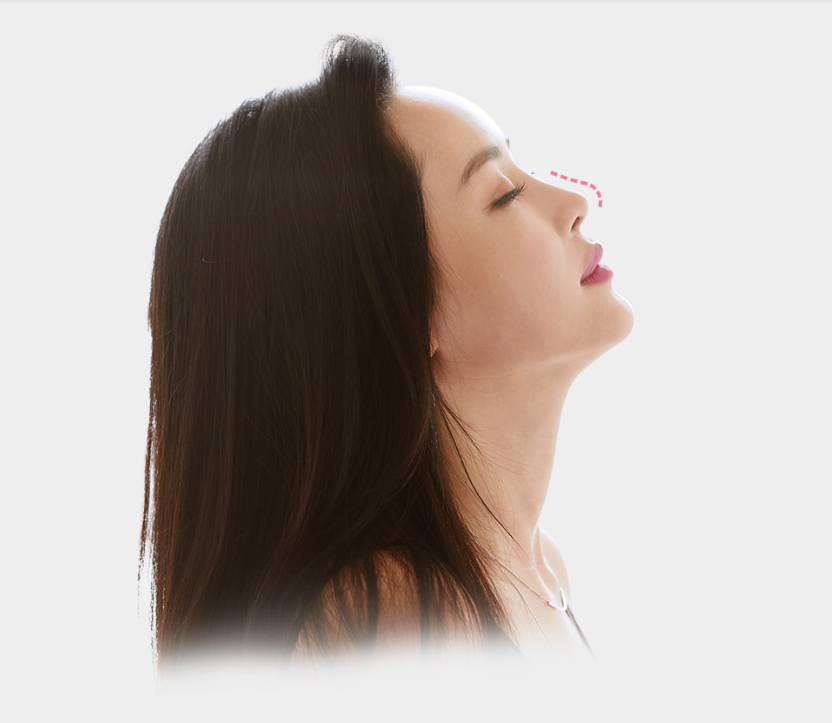 코재수술비용 코재수술병원 바노바기는 제대로 합니다! 관련 이미지 2