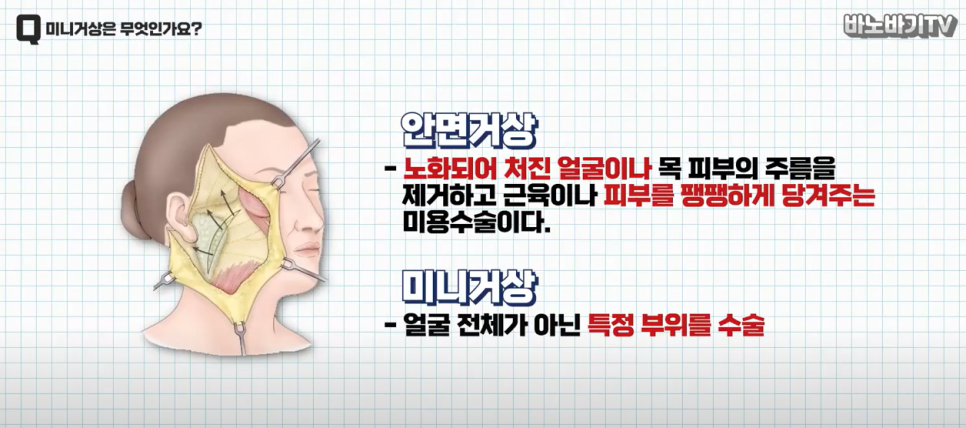 미니거상을 받아야 하는 시기는 언제일까요? 관련 이미지 1