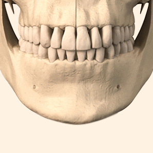 앞턱 수술, 얼굴형과 조화를 이루는 턱 선이 작은 얼굴을 결정짓는다. 관련 이미지 3