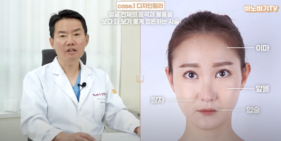 아테콜 필러의 장점과 아테콜 추천 부위는?! 관련 이미지 7