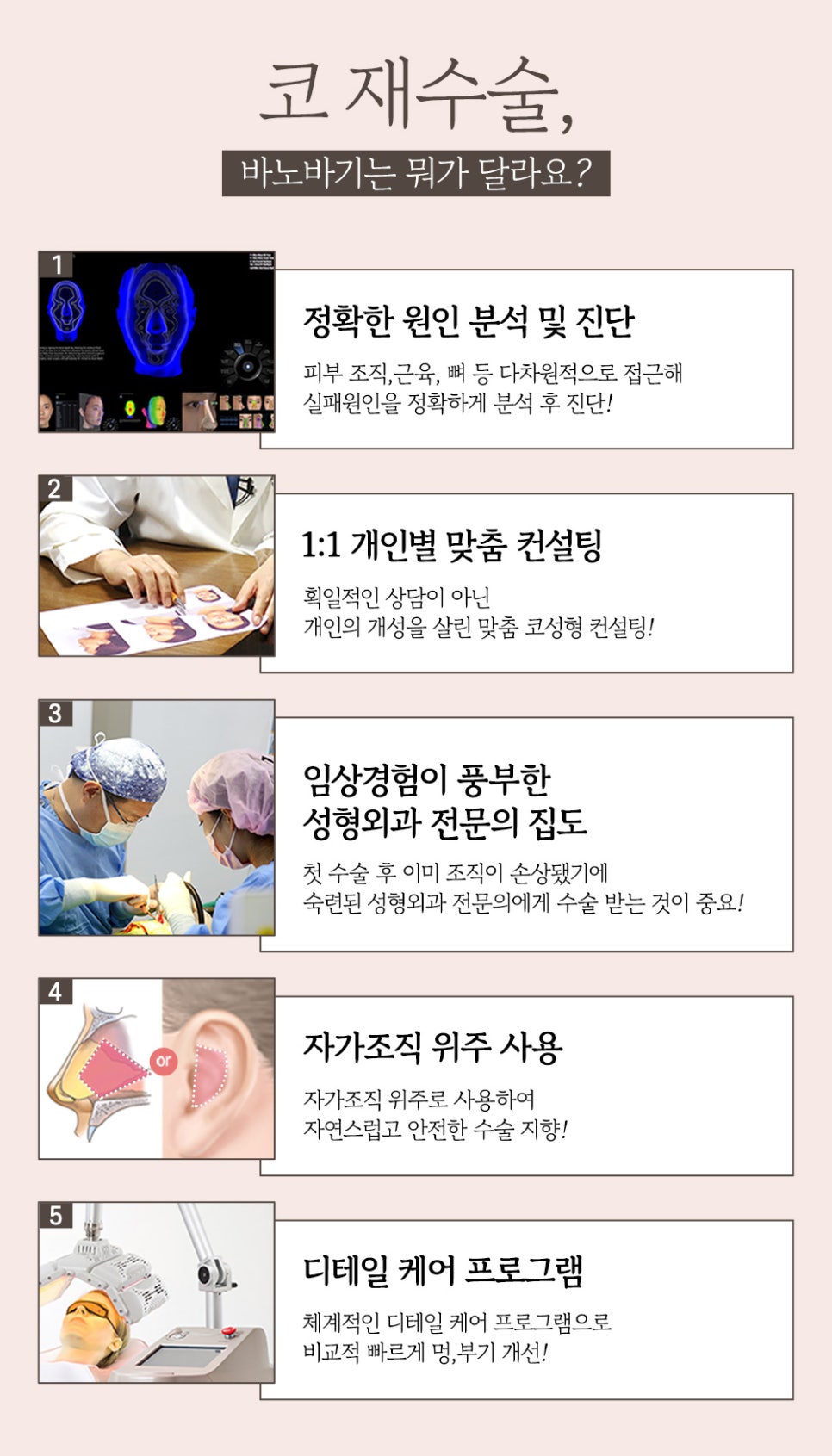 코 재수술의 다양한 원인과 개선 방법! 관련 이미지 15