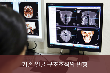 윤곽 재수술 경험과 기술을 갖춘 전문의에게 받아야 합니다. 관련 이미지 3